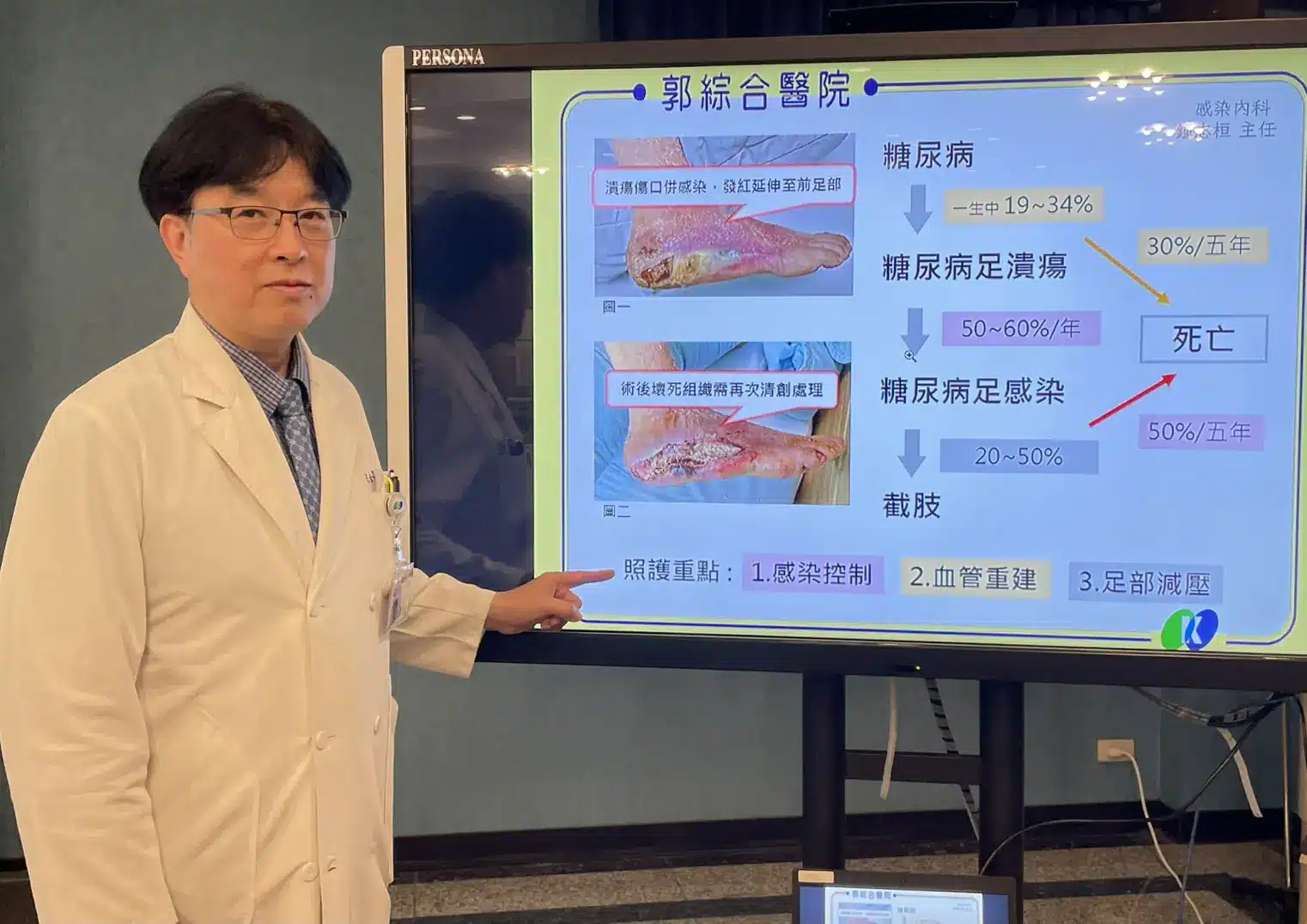 糖友”足部潰瘍傷口”不可輕忽 小心截肢及死亡風險