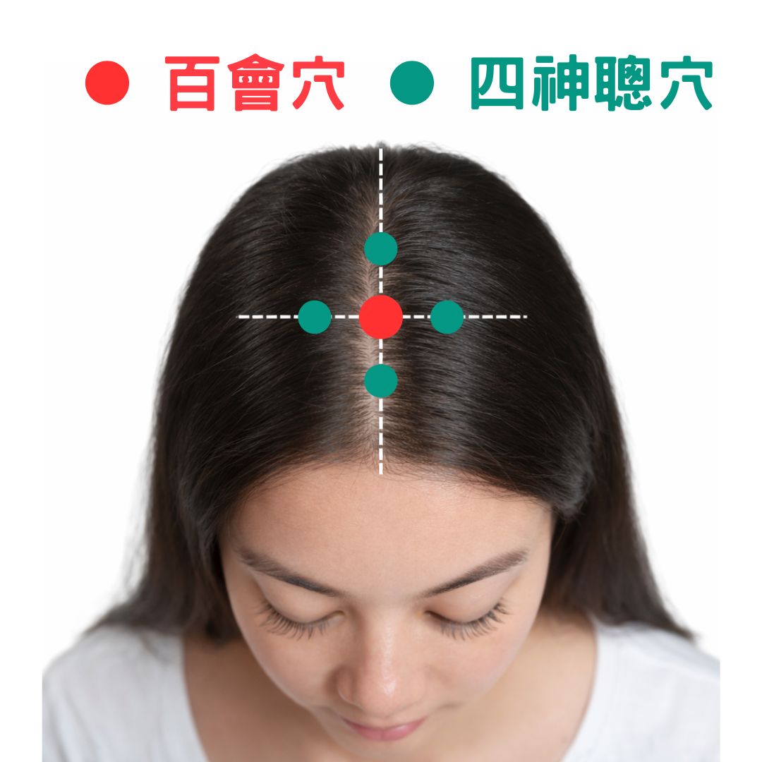 64歲婦人失眠7年難入睡　中醫疏肝理氣助一覺到天亮