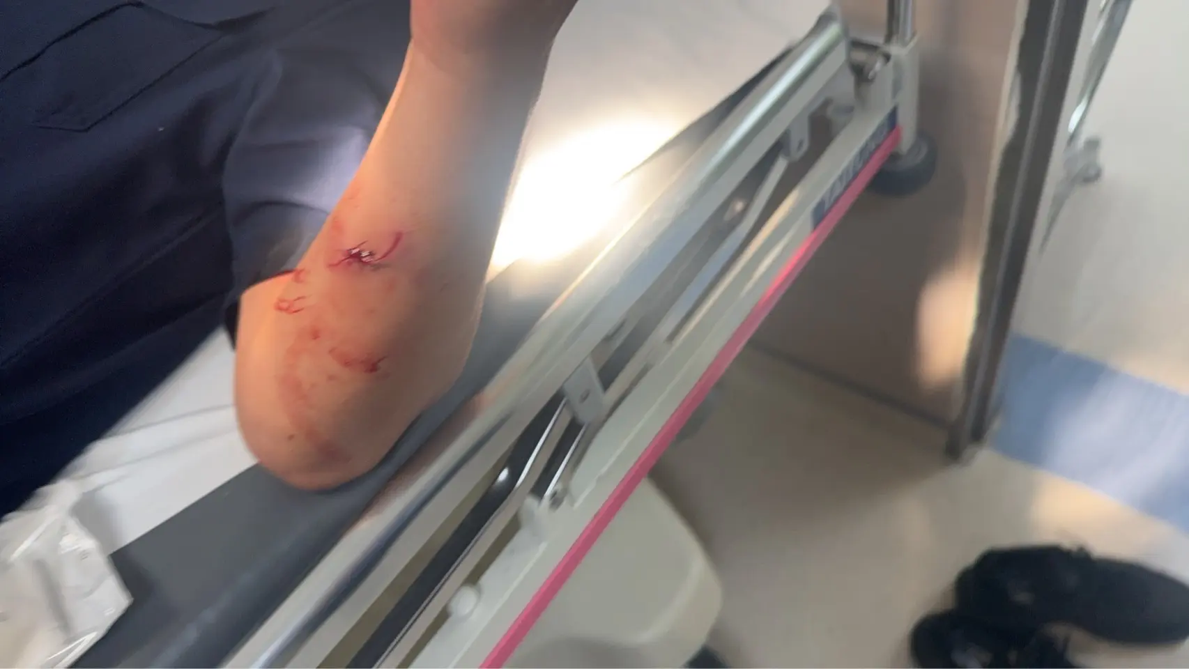 警員手部受傷濺血。翻攝畫面