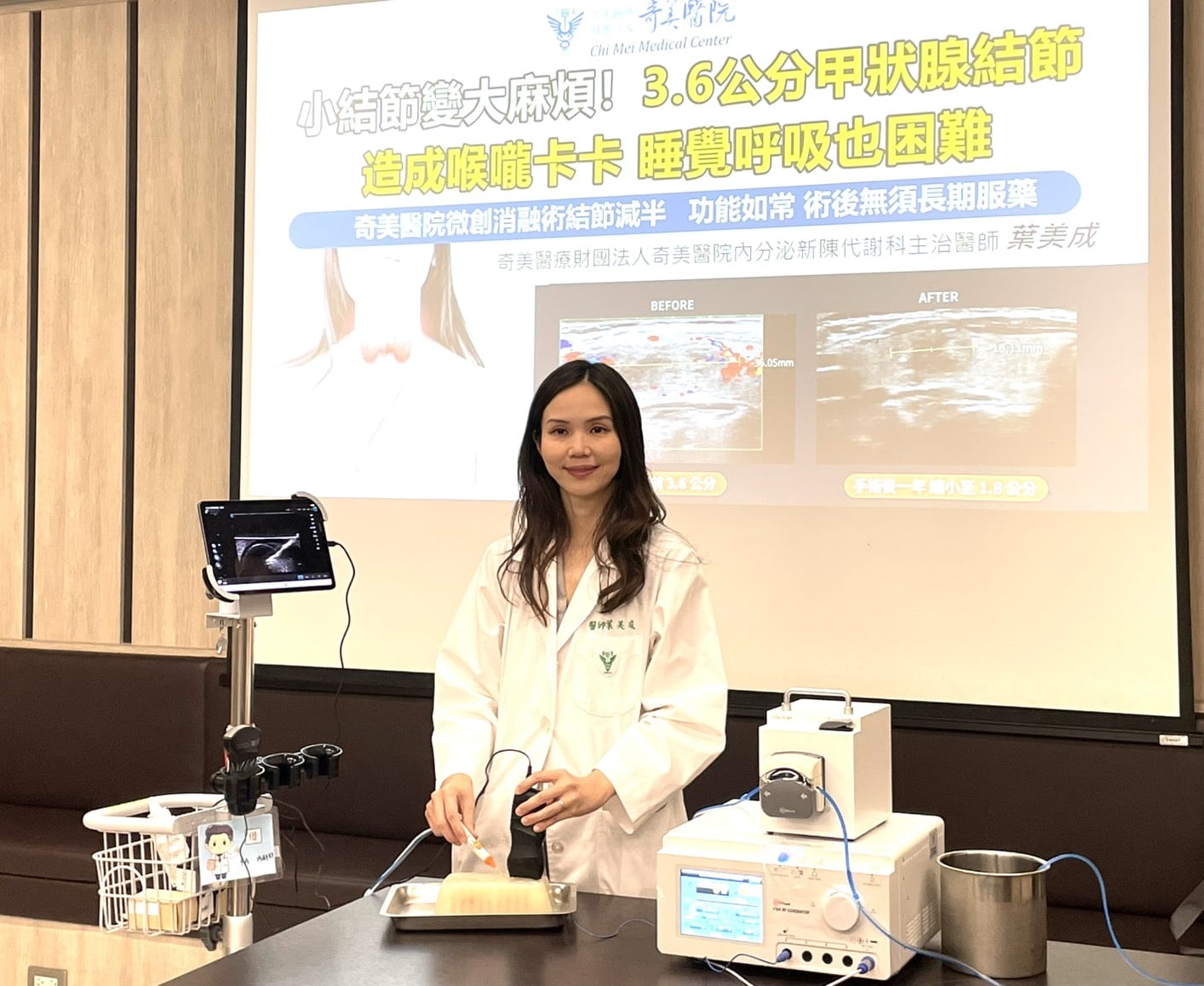 婦人3.6公分甲狀腺結節 奇美醫院微創消融術結節減半、功能如常，術後無須長期服藥