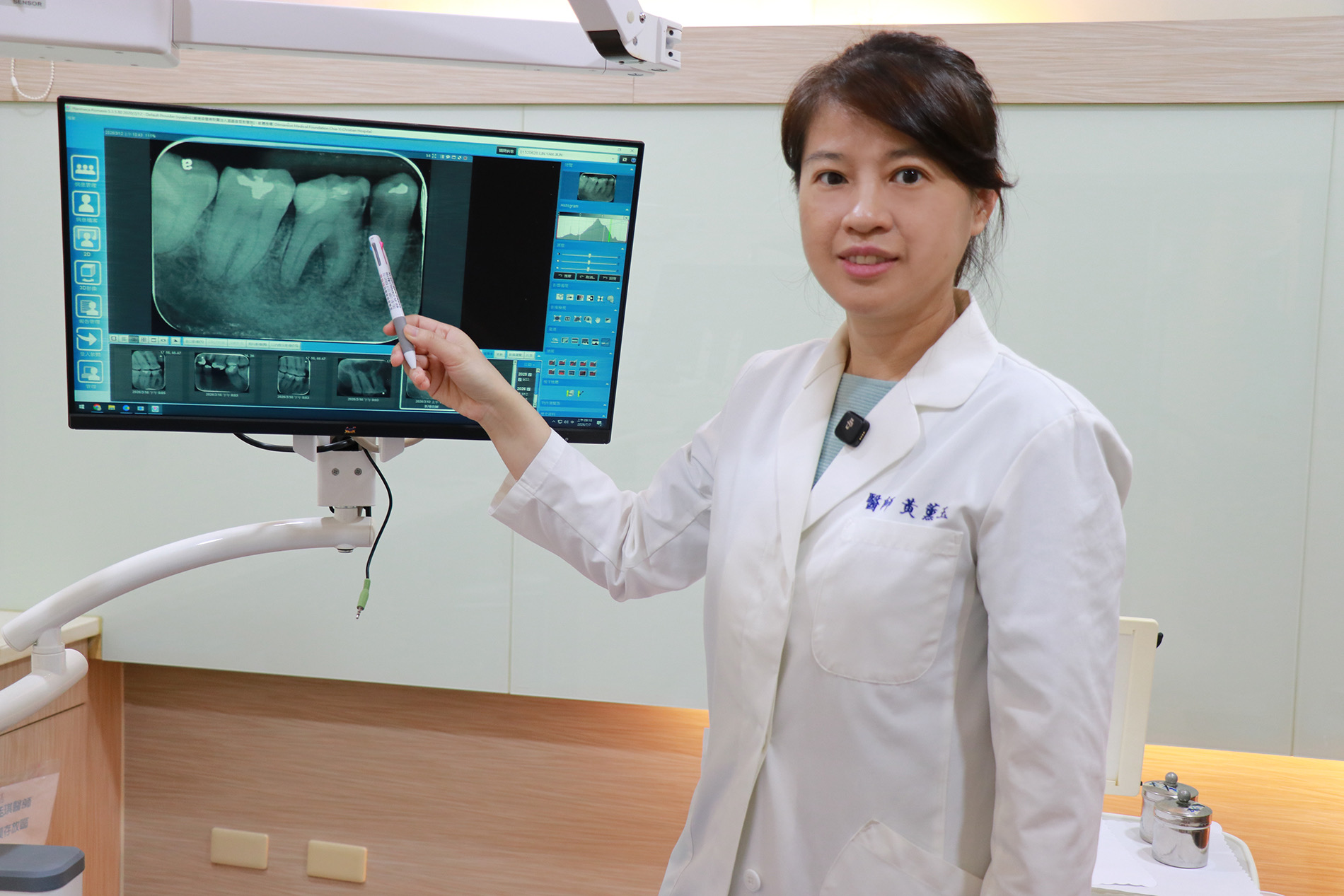 蛀牙一定要抽神經？嘉基曝保牙新技術　成功率約8成